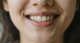 dreams of missing teeth